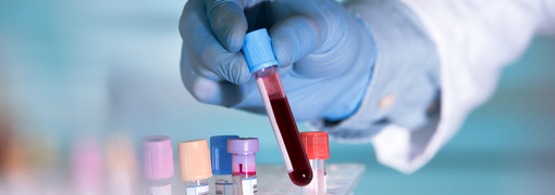  בדיקת Hepatitis A IgG Antibodies - תמונה